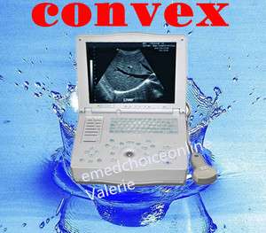 15.1 inch Laptop Ultrasound Scanner with 3.5 MHz Convex Probe Curved 