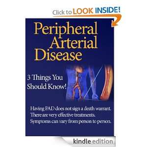 Peripheral Arterial Disease   3 Things You Should Know Erica Harris 