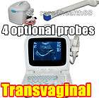 new digital ultrasound scanner transvaginal probe 6000c returns 