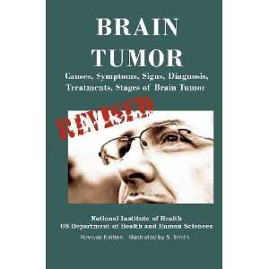  Brain Tumor Causes, Symptoms, Signs, Diagnosis 