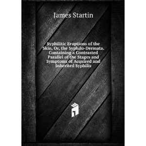   and Symptoms of Acquired and Inherited Syphilis James Startin Books