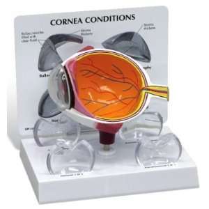  Cornea Cross Section Human Eye Anatomical Model #2780 
