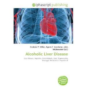  Alcoholic Liver Disease (9786133743380) Books