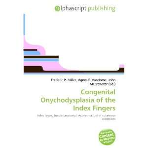  Congenital Onychodysplasia of the Index Fingers 