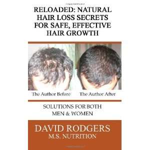  Reloaded Natural Hair Loss Secrets for Safe, Effective 