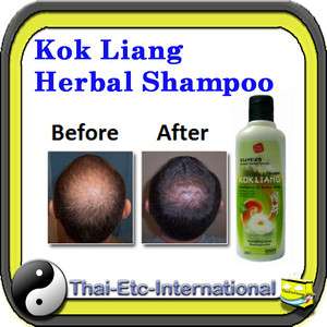 KOKLIANG KOK LIANG Anti hair loss dandruff herbal scalp soothes 
